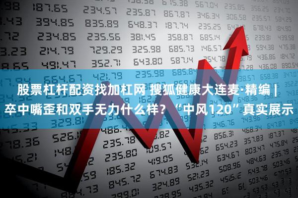 股票杠杆配资找加杠网 搜狐健康大连麦·精编 | 卒中嘴歪和双手无力什么样？“中风120”真实展示